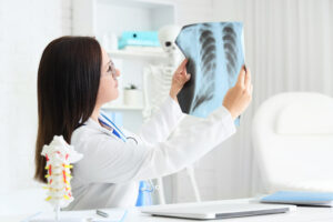 mulher segurando exame de imagem do pulmao