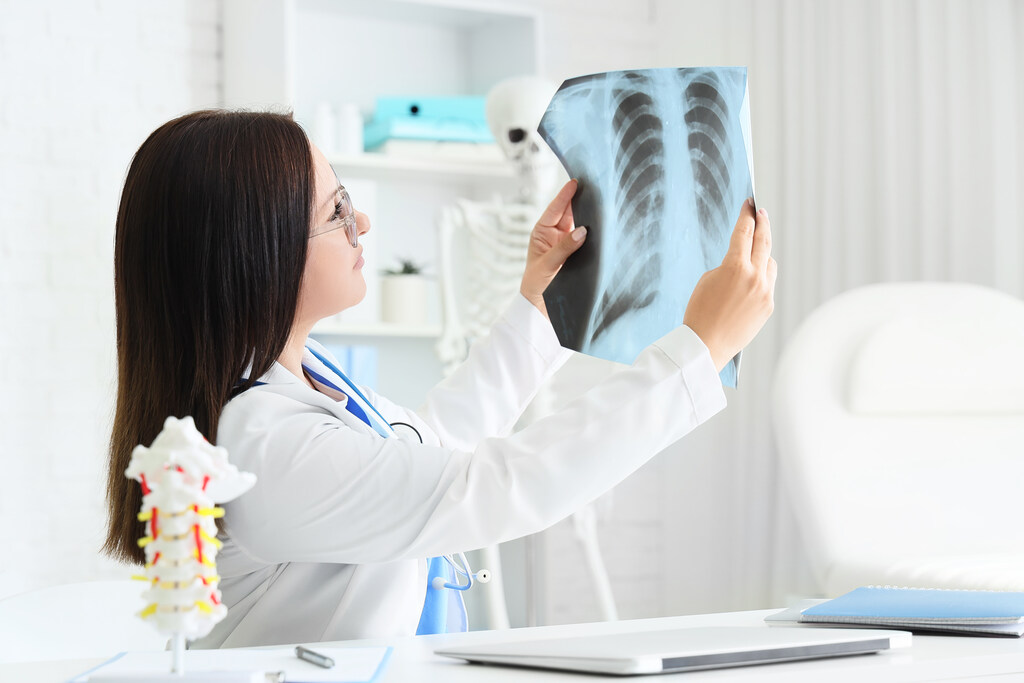 mulher segurando exame de imagem do pulmao